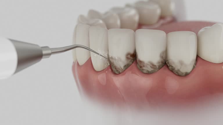 Reliable Tooth Extraction contractor in Tyler County County, TX by Dentist Open Now